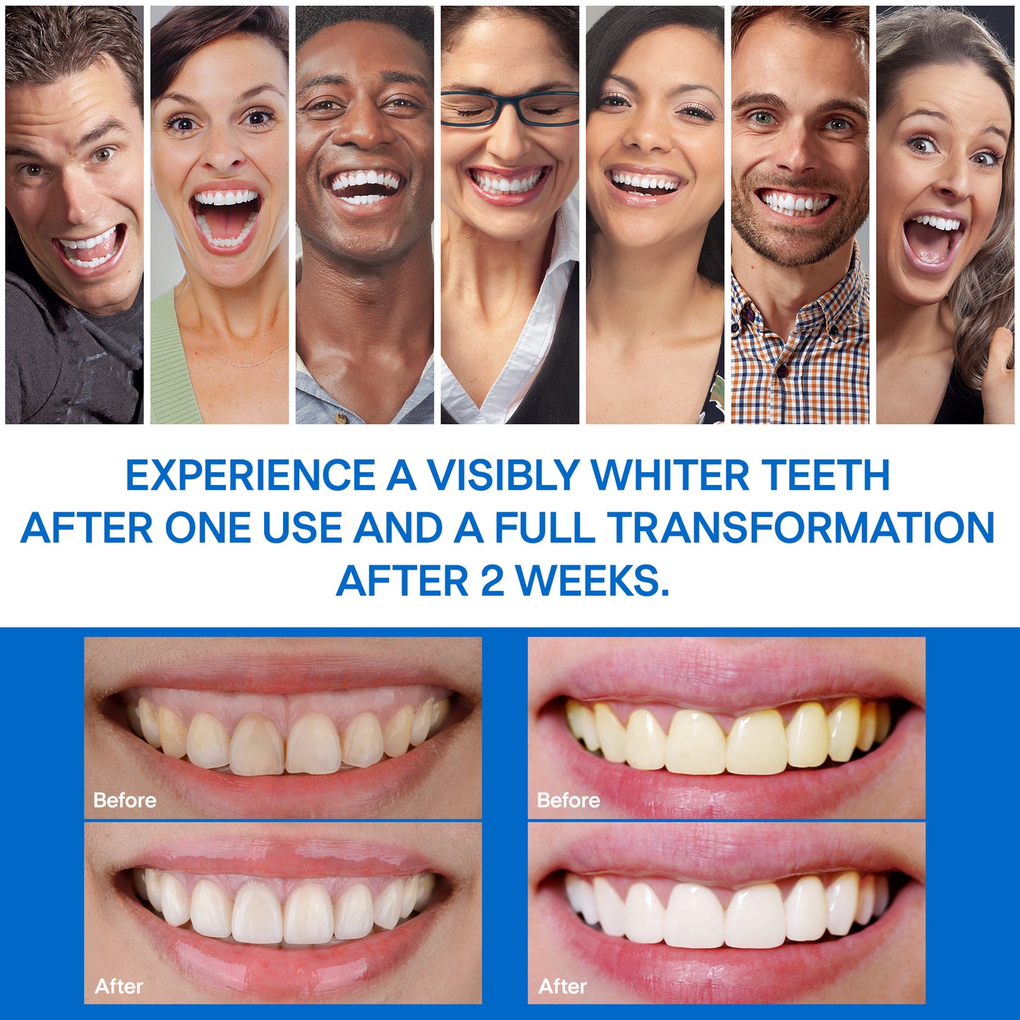 Teeth Whitening & Bright Strips, 32 White Strips Teeth Whitening Kit, Non-Sensitive 16 Sets Teeth Whitener for Tooth Whitening, Helps to Remove Smoking Coffee Soda Wine Stain, Up to 10 Shades Whiter